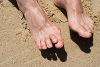 What are Signs of Hammertoe?