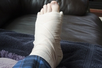 Foot Fractures in Pickleball Play